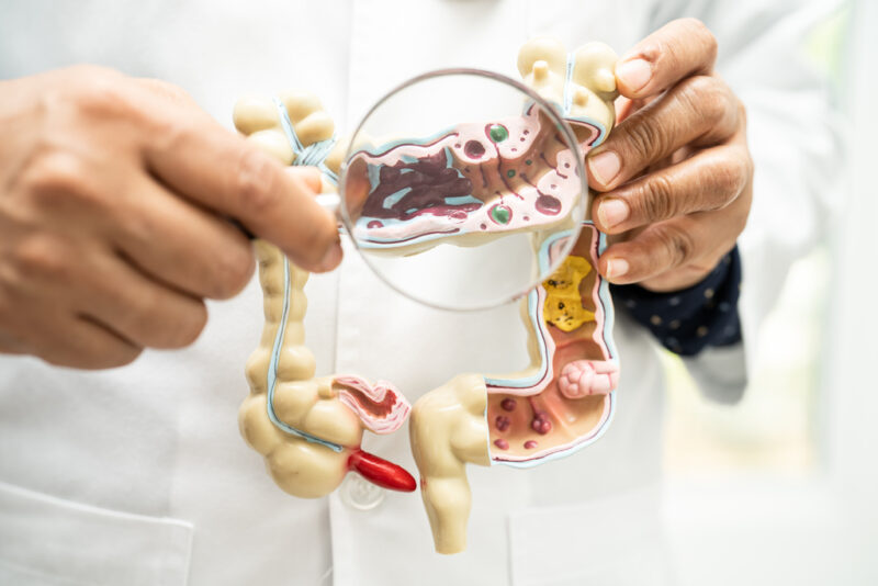 Penyakit Invaginasi - Kenali gejala, penyebab, dan kapan harus ke dokter